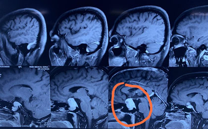 Removed the big iron piece