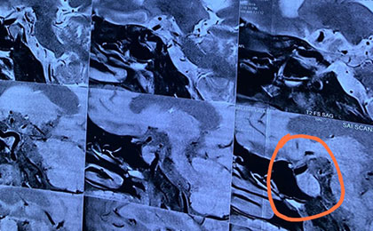 Removed the big iron piece